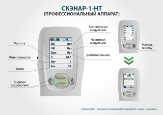 СКЭНАР-1-НТ (исполнение 01)  в Абакане купить Скэнар официальный сайт - denasvertebra.ru 